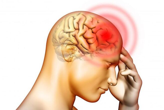 Les maux de tête peuvent être un symptôme de larves de vers ronds dans l'oreille moyenne