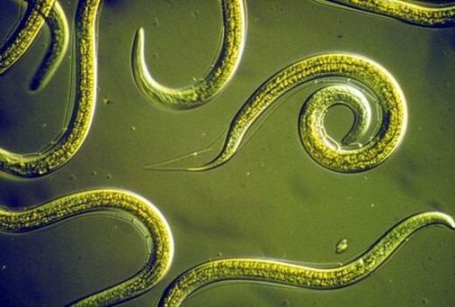 Nématodes parasites dans l'intestin grêle humain